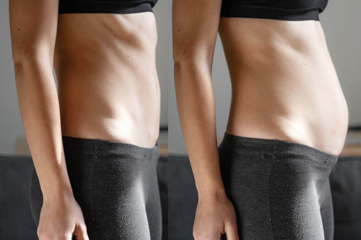How long does diastasis recti take to improve Blackheath?
