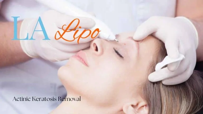 Woman receiving Actinic Keratosis Removal Treatment Blackheath