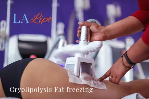 women getting fat freezing Blackheath