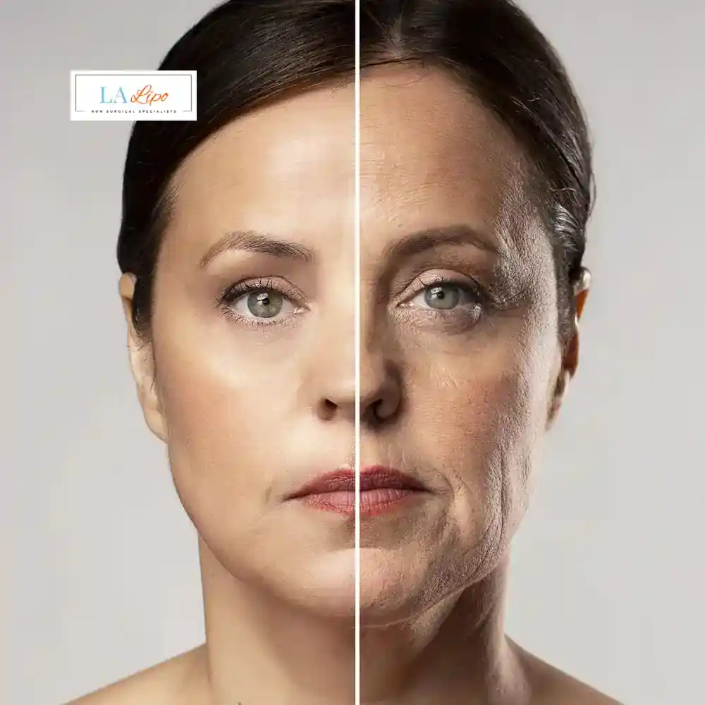 How Can You Tell If Non-Surgical Skin Tightening Is Right for You Blackheath?