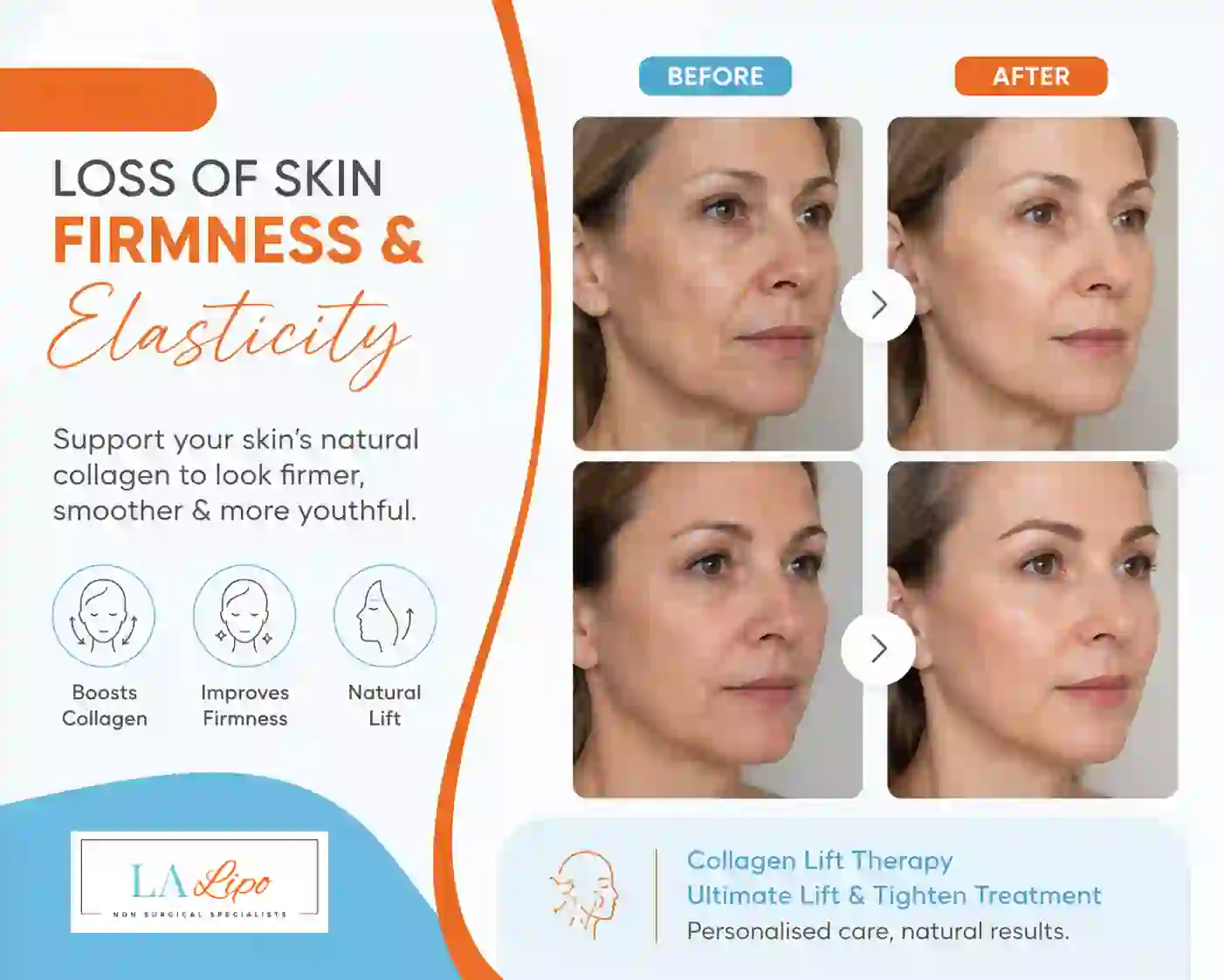 Sign #7: Loss of Skin Firmness and Elasticity Blackheath