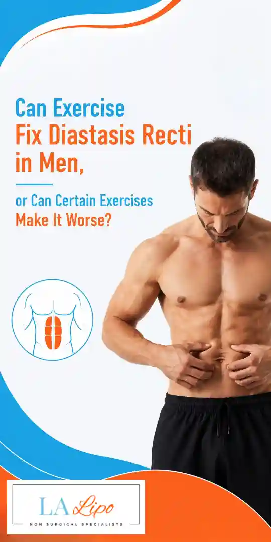 Can Exercise Fix Diastasis Recti in Men, or Can Certain Exercises Make It Worse Blackheath?